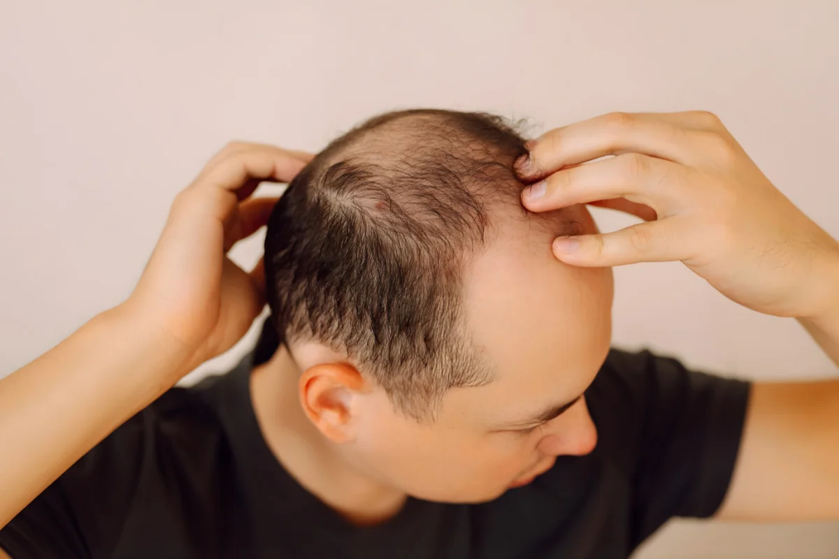  Hair Fall, Hair Loss & Scalp Disorders (PRP, GFC,
                              HT)